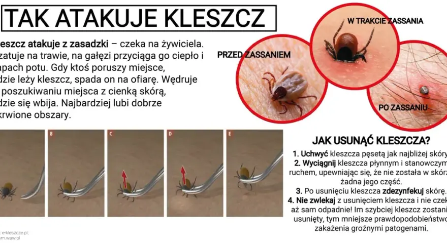 Kleszcz pod skórą to mit! Jak rozpoznać i bezpiecznie usunąć?